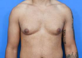 Patient Before & After Image