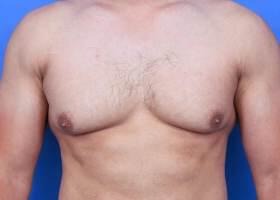 Patient Before & After Image