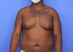 Patient Before & After Image