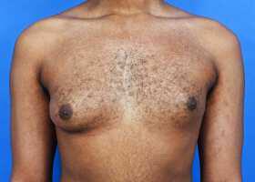 Patient Before & After Image