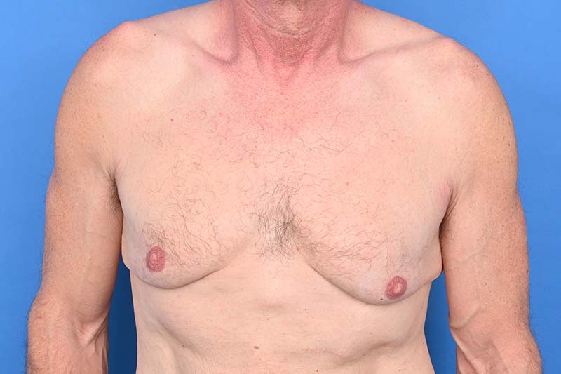 Patient Before & After Image