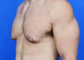 Patient Before & After Image