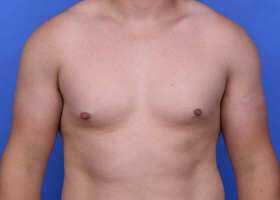 Patient Before & After Image