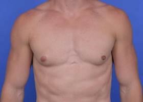 Patient Before & After Image