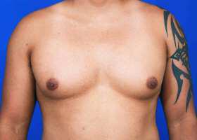 Patient Before & After Image