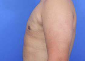 Patient Before & After Image