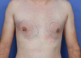 Patient Before & After Image