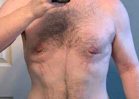 Patient Before & After Image