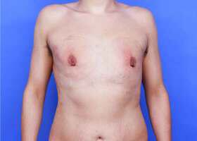 Patient Before & After Image