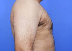 Patient Before & After Image