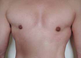 Patient Before & After Image