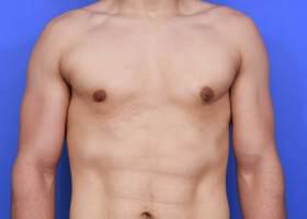 Patient Before & After Image