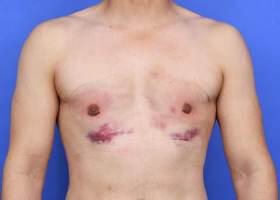 Patient Before & After Image