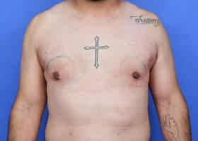 Patient Before & After Image