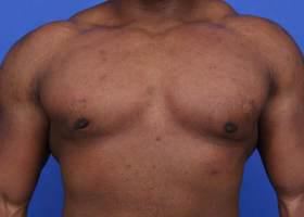 Patient Before & After Image