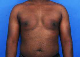 Patient Before & After Image