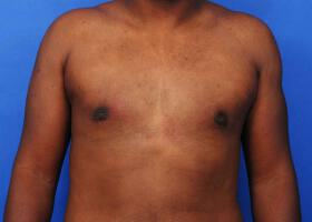 Patient Before & After Image