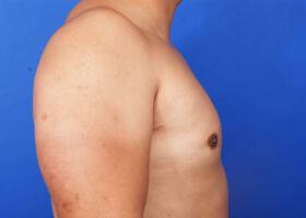 Patient Before & After Image