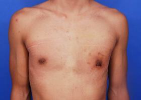 Patient Before & After Image