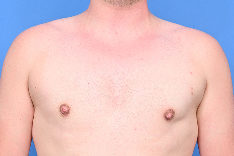 Patient Before & After Image