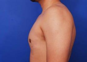 Patient Before & After Image