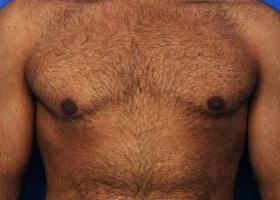 Patient Before & After Image