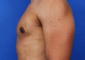 Patient Before & After Image