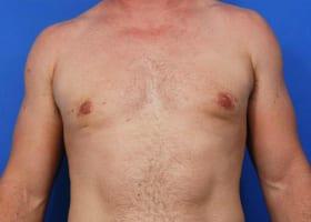 Patient Before & After Image