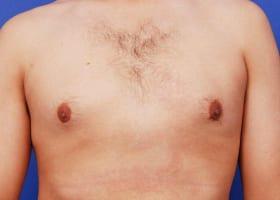 Patient Before & After Image