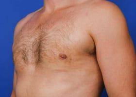 Patient Before & After Image