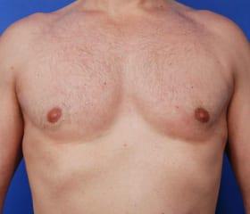 Patient Before & After Image