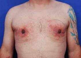 Patient Before & After Image