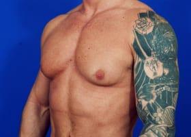 Patient Before & After Image