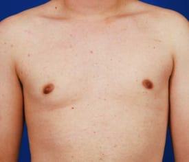 Patient Before & After Image