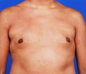 Patient Before & After Image