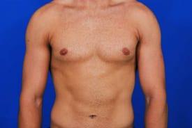 Patient Before & After Image