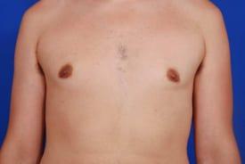 Patient Before & After Image