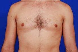 Patient Before & After Image