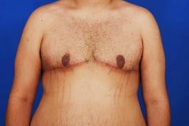 Patient Before & After Image