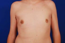 Patient Before & After Image