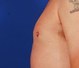 Patient Before & After Image