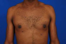 Patient Before & After Image