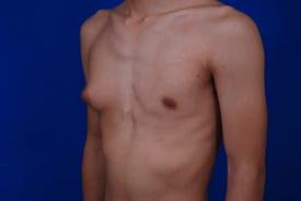 Patient Before & After Image