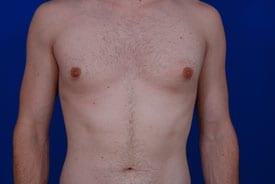 Patient Before & After Image