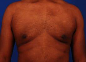 Patient Before & After Image