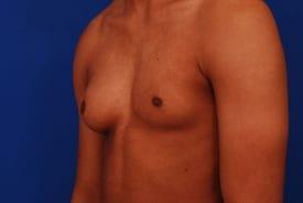 Patient Before & After Image