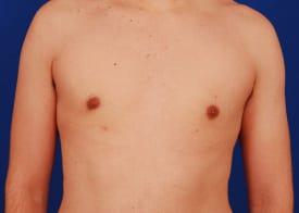 Patient Before & After Image