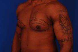 Patient Before & After Image