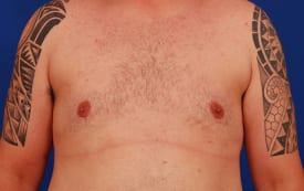 Patient Before & After Image