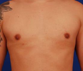 Patient Before & After Image